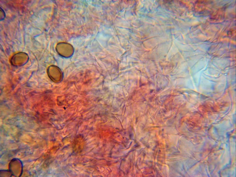 Agrocybe elatella 10 - Pileipellis x 1000